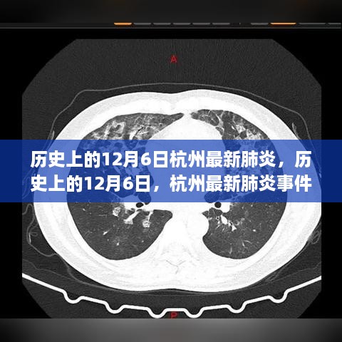 历史上的12月6日杭州最新肺炎事件深度解析与评估