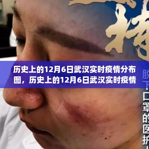 多维度视角下的武汉疫情分布图，历史上的12月6日实时观察与思考